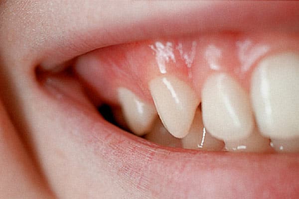 سلامت دهان و دندان